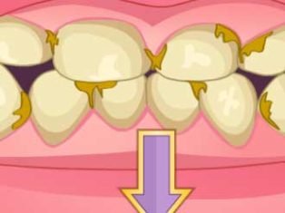 poster of Bad Teeth Makeover game